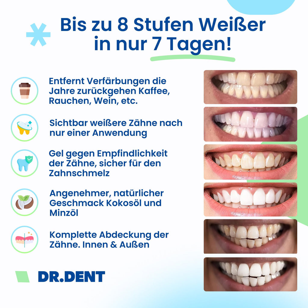 DRDENT Professional Teeth Whitening Strips 21 Treatments - Safe for Enamel - Non Sensitive Teeth Whitening - Whitening Without Any Harm + Mouth Opener Included